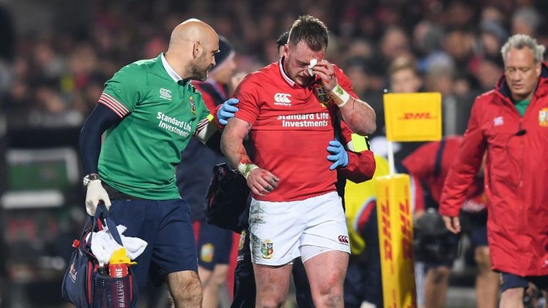 Scotland suffer Stuart Hogg injury blow