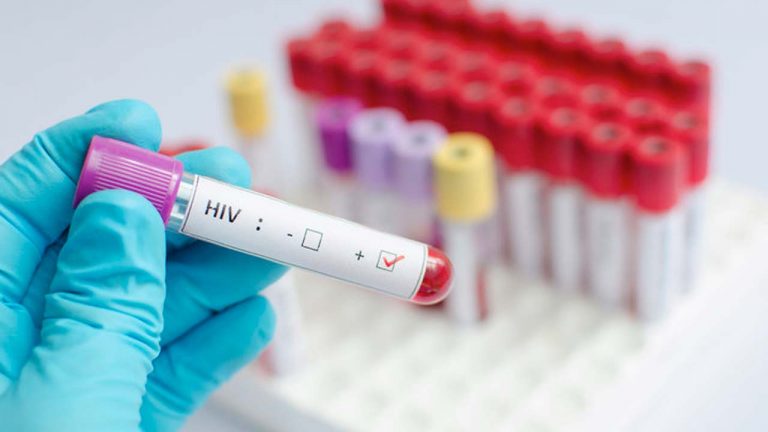 Second HIV remission patient rekindles cure hope