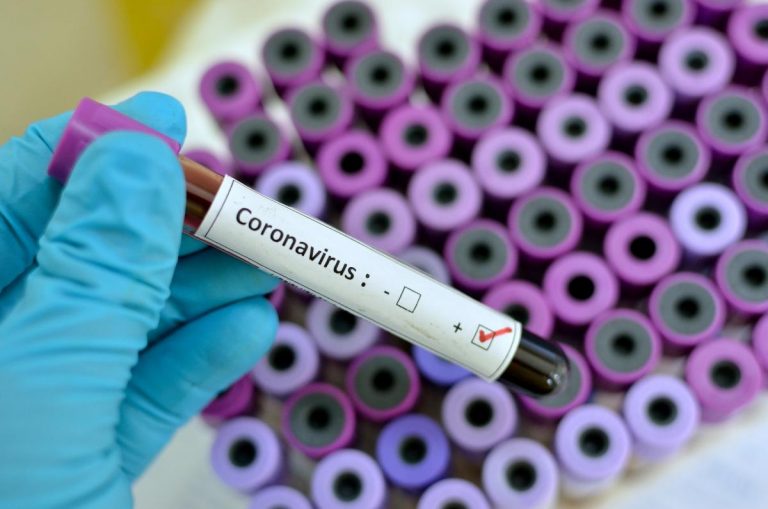 Coronavirus: Aussie scientists claim breakthrough