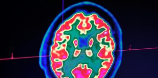 Confusion, seizure, strokes: How COVID-19 may affect the brain