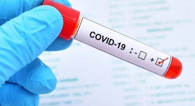 RANDOM ANTIGEN TESTS FOR OUTBOUND TRAVELLERS OF THE WESTERN PROVINCE – ARMY COMMANDER