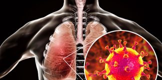 260 Covid-19 cases reported today