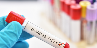 592 Covid positive cases