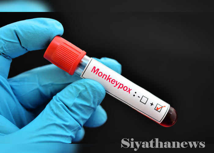 WHO to rename Monkeypox as ‘MPOX’