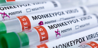 Sri Lanka detects its first Monkeypox case